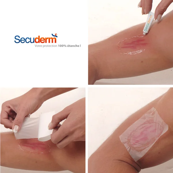 SURPANSEMENT ETANCHE SECUDERM 10x20CM M